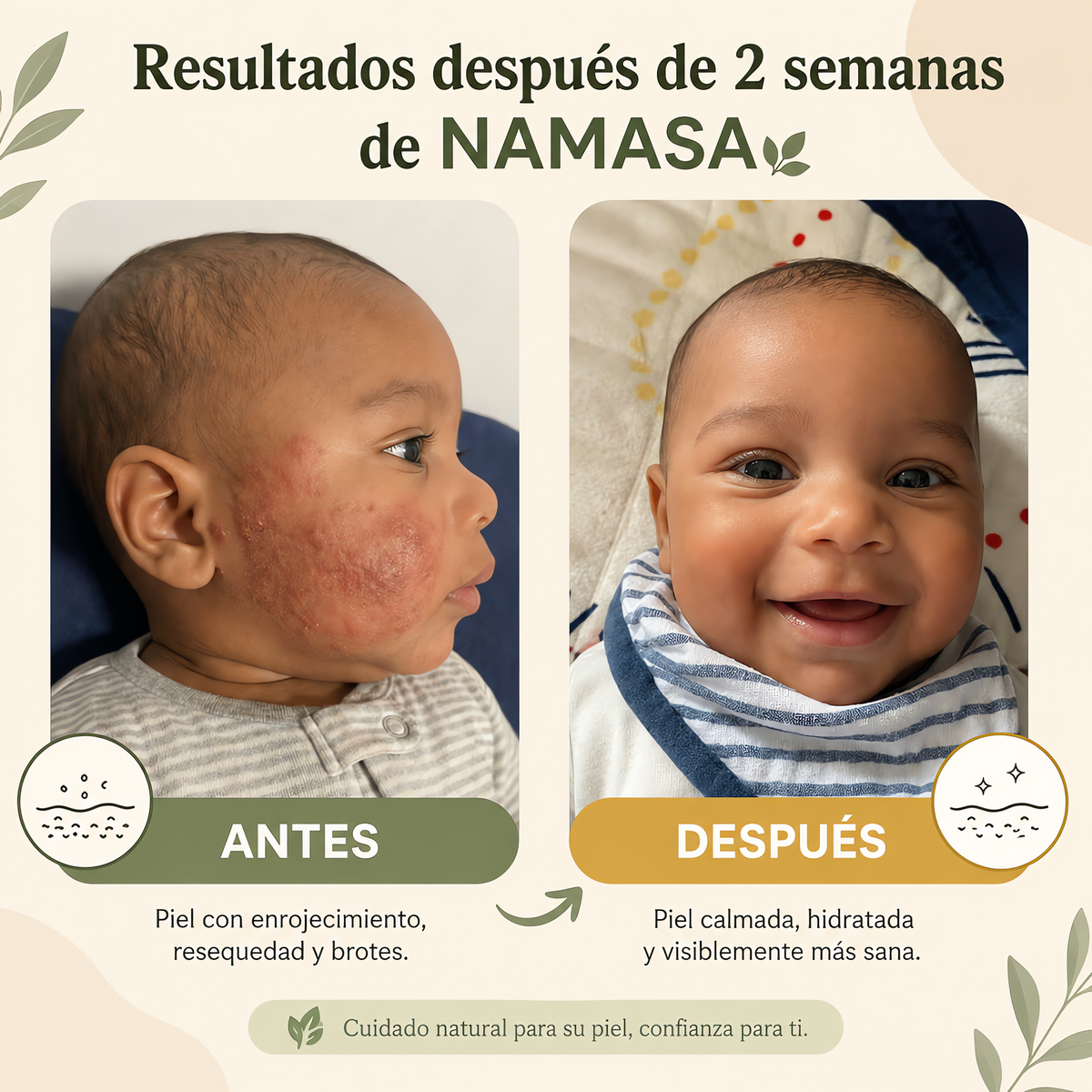NAMASA™ Crema de Miel para Eczema