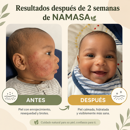 NAMASA™ Crema de Miel para Eczema