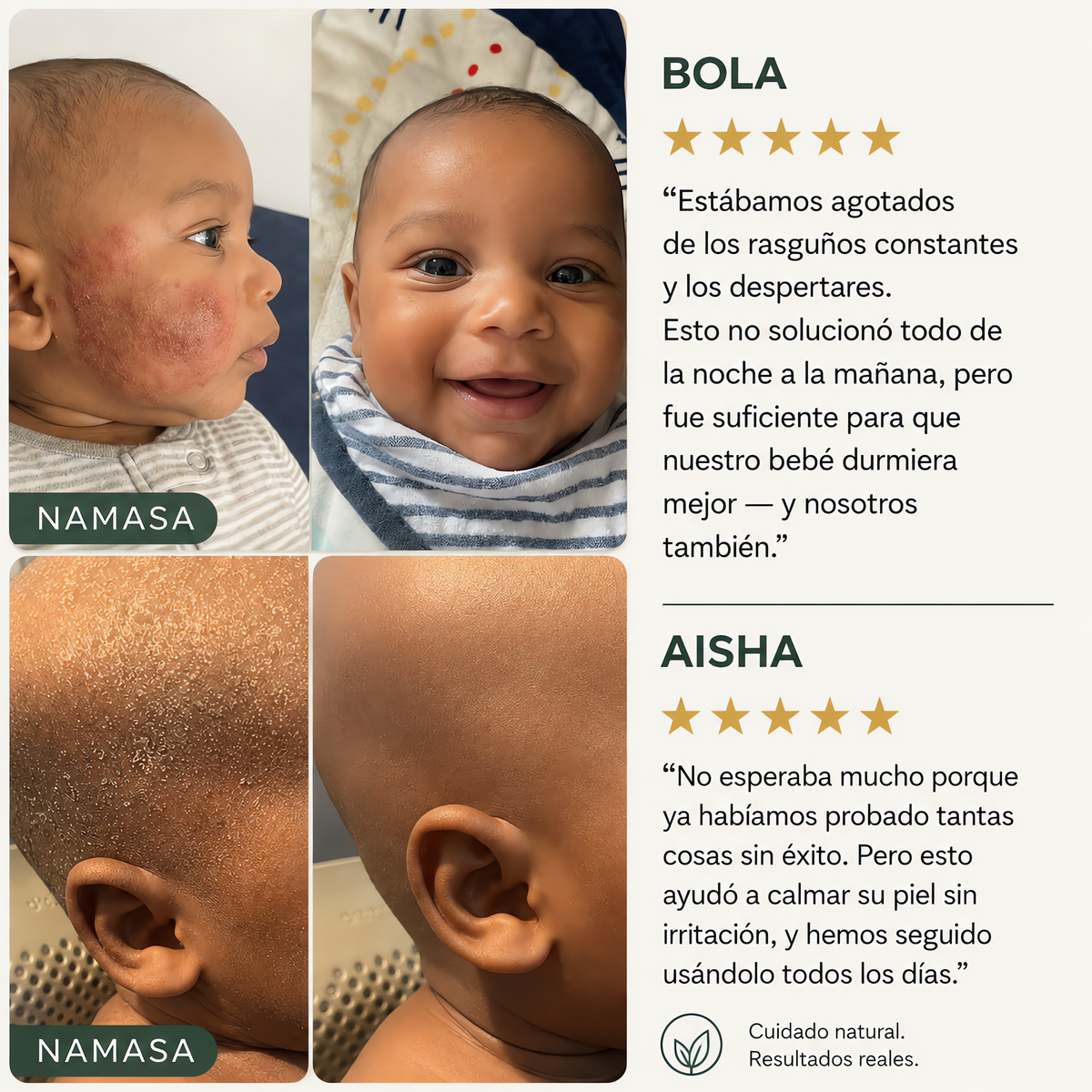 NAMASA™ Crema de Miel para Eczema